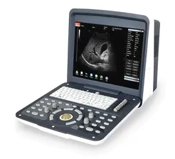 Ветеринарный узи сканер AcuVista RS880d 15-дюймовый экран