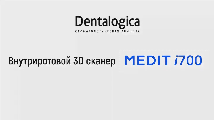 Внутриротовой (интероральный) 3D сканер в стоматологической клинике Dentalogica