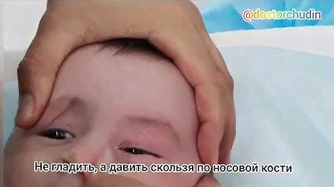 Массаж слёзного мешка, носослёзного канала. Непроходимость носослезного канала новорождённых