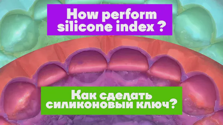 How perform silicone index for mock-up? / Как сделать силиконовый ключ?